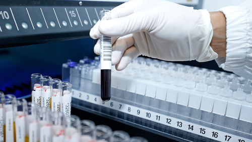 科學(xué)技術(shù)發(fā)展基金資助26項(xiàng)新型冠狀病毒感染科研項(xiàng)目助力技術(shù)開發(fā)